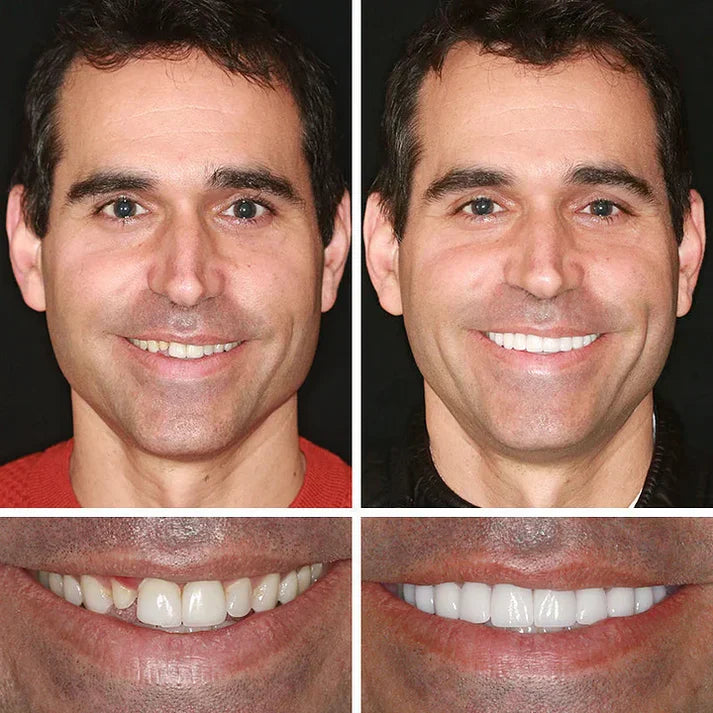 Ends Today: 70% OFF Fresh Smile, Better Fit