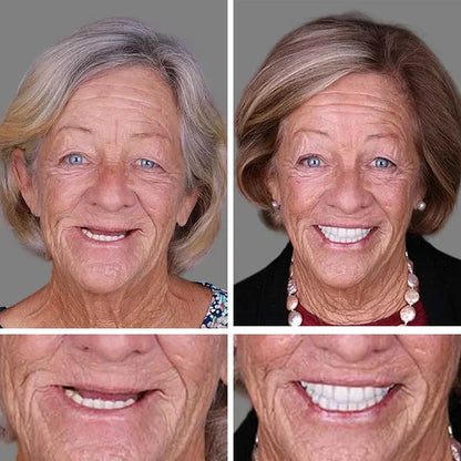 Ends Today: 70% OFF Fresh Smile, Better Fit