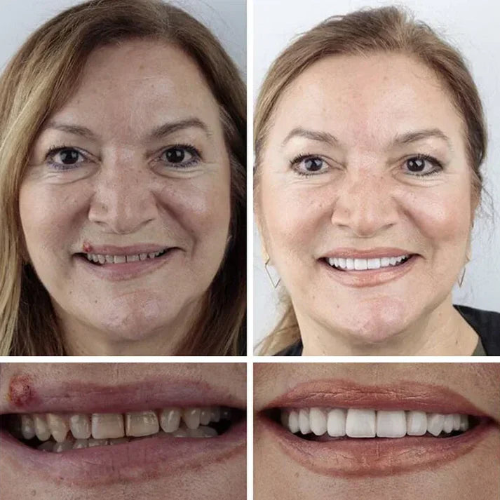 Ends Today: 70% OFF Fresh Smile, Better Fit