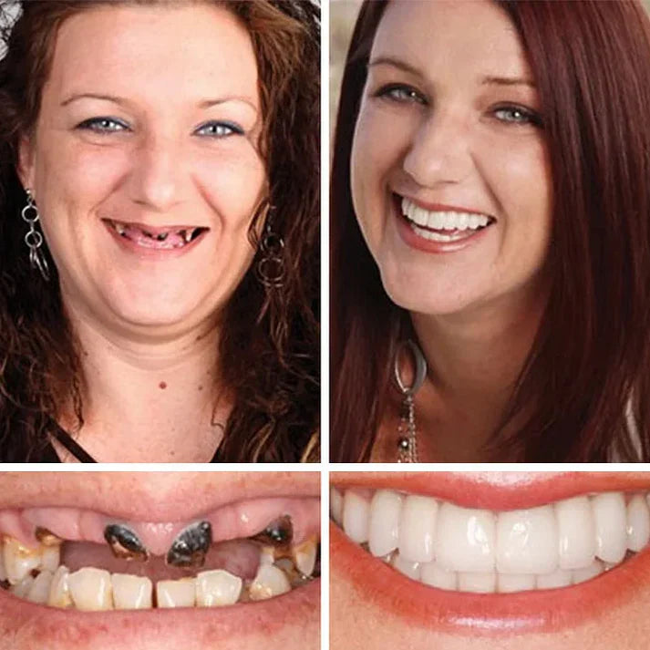 Ends Today: 70% OFF Fresh Smile, Better Fit